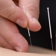 accupuncture-needling-facts-900×600