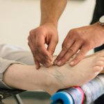 close up of the acupuncturist treating someones ankle