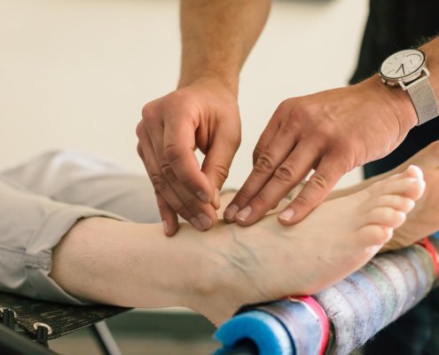 close up of the acupuncturist treating someones ankle